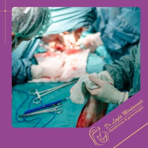 جراحی هیسترکتومی جراحی هیسترکتومی