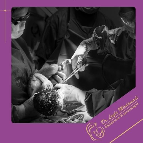 تفاوت‌ سزارین الکتیو و اورژانسی 