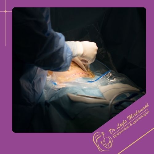 عوارض احتمالی جراحی سزارین