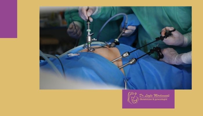 لاپاراسکوپی چیست، چگونه انجام می شود؟ و بهترین جراح برای انجام آن