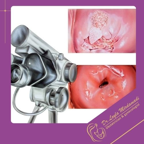 کاربردهای معاینه با کولپوسکوپ