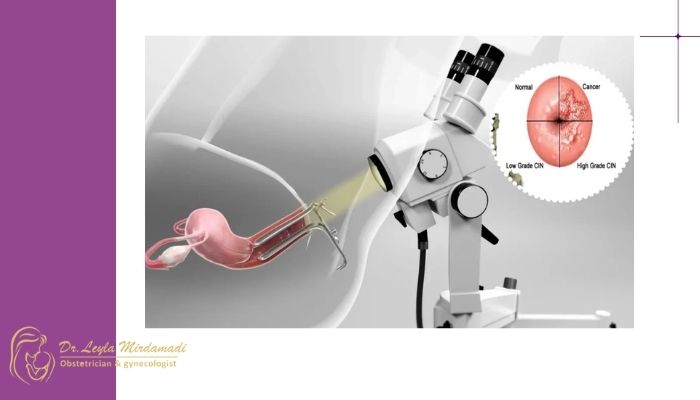 مراحل معاینه دهانه رحم با کولپوسکوپ