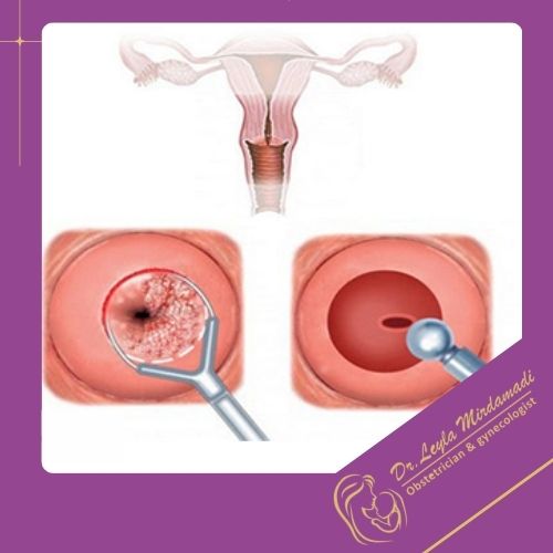 زخم دهانه رحم و ضایعات پوستی چیست؟