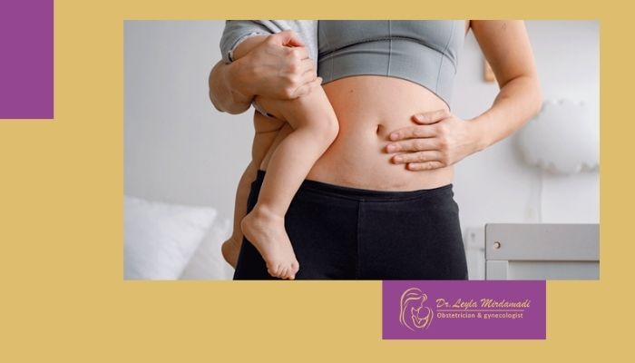 آیا خونریزی بیش از ۴۰ روز بعد از زایمان سزارین طبیعی است؟