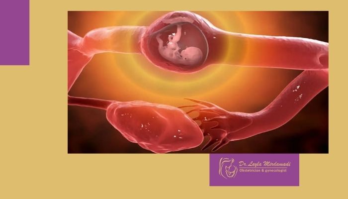 بارداری خارج از رحم چیست؟ از علائم تا تشخیص و درمان