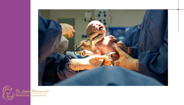 در چه شرایطی ممکن است سزارین زودتر انجام شود؟ در چه شرایطی ممکن است سزارین زودتر انجام شود؟