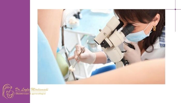 روند انجام کولپوسکوپی چگونه است؟