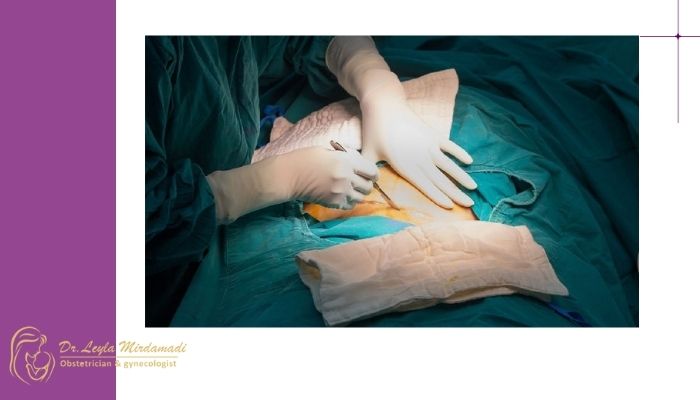 زمان استاندارد برای انجام زایمان سزارین زمان استاندارد برای انجام زایمان سزارین