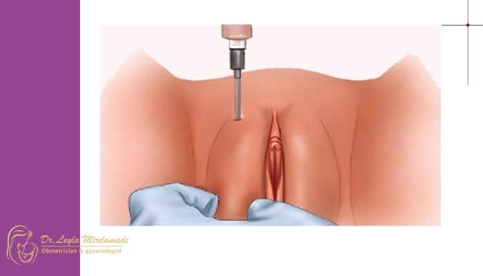 عوارض احتمالی هر یک از روش ها عوارض احتمالی هر یک از روش ها
