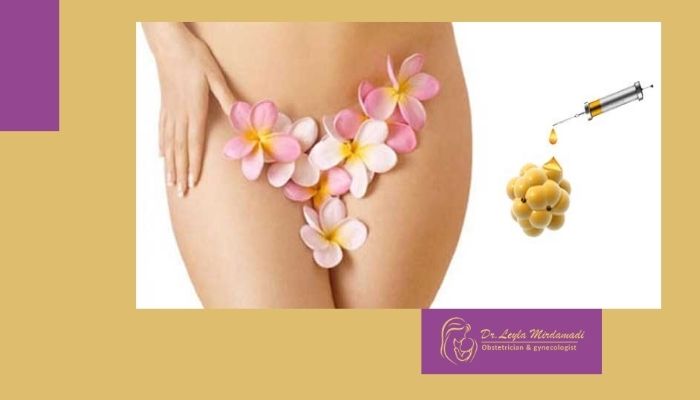 هزینه تزریق ژل به واژن در تهران چقدر است؟ هزینه تزریق ژل به واژن در تهران چقدر است؟